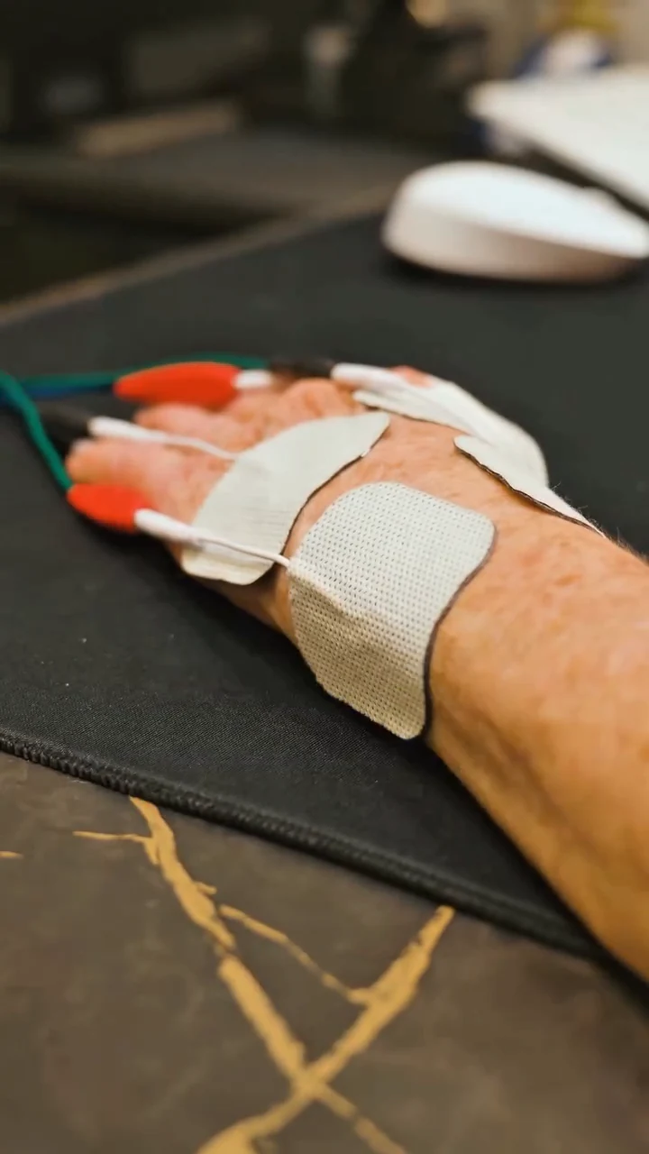 Mão de um paciente com eletrodos de fisioterapia, apoiada sobre uma mesa de mármore preto com veios dourados
